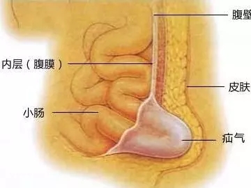 6岁男孩“命根子”仅1厘米！医生检查后发现